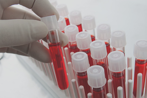 Comment réduire l'adrénaline