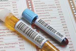 Comment faire baisser l'acide urique dans le sang