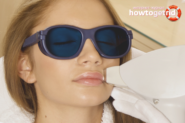 Cosmétiques et méthodes pour se débarrasser des antennes