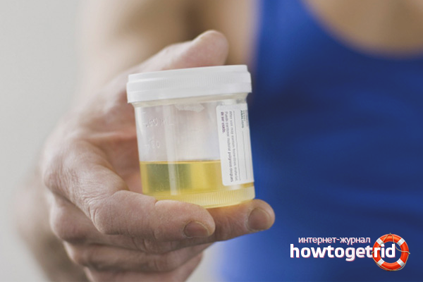 Comment collecter l'urine à l'aide d'un sac en plastique