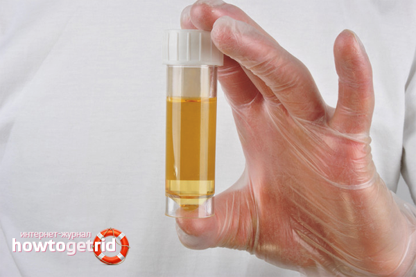 Comment collecter l'urine chez une fille nouveau-née