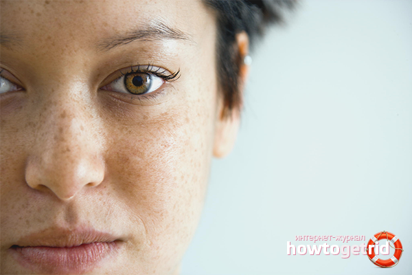 Comment se débarrasser des taches de vieillesse sur le visage