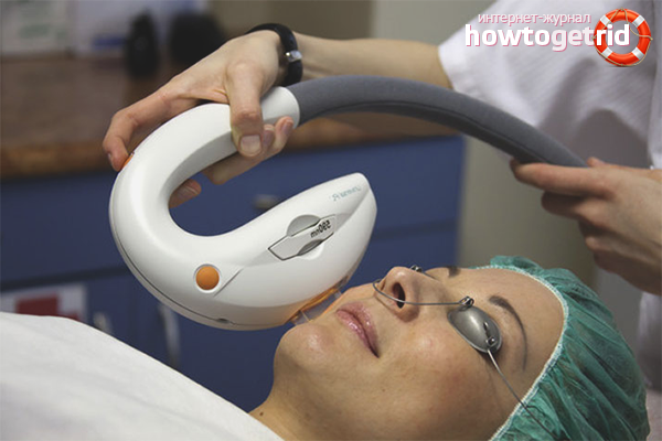 Services cosmétiques des taches de vieillesse