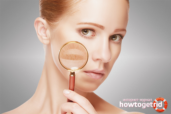 Prévention des taches de vieillesse