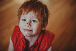 Comment laver la fucorcine de la peau