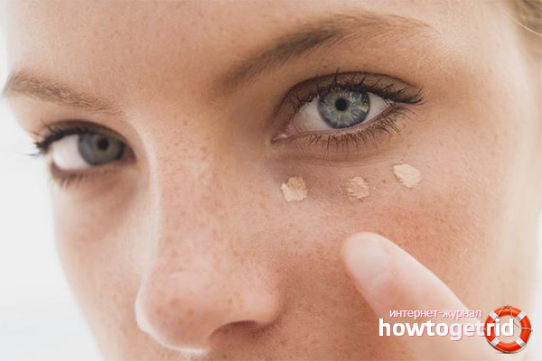 Comment cacher une ecchymose