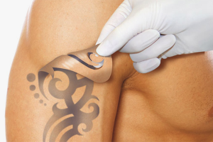 Comment se faire tatouer