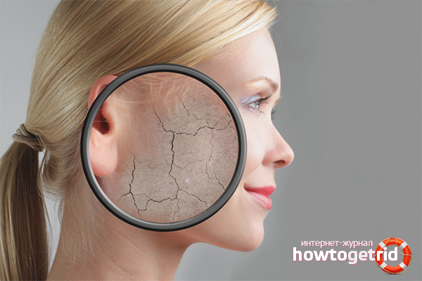 Comment se débarrasser de la peau qui pèle sur le visage