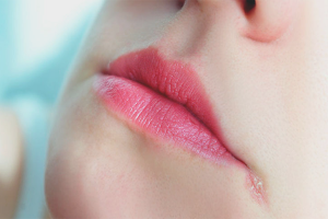 Comment soigner les mâchoires aux coins de la bouche