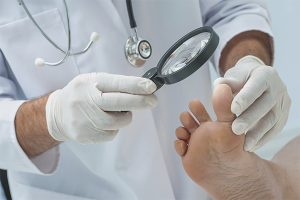 Comment traiter les champignons des pieds