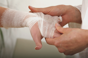 Comment traiter une brûlure causée par l'eau bouillante