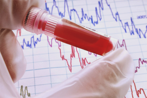 Comment faire baisser la bilirubine dans le sang