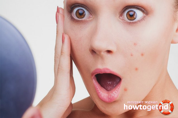 Comment masquer l'acné sur votre visage