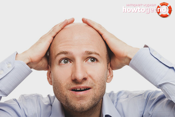 Comment arrêter la perte de cheveux chez un homme