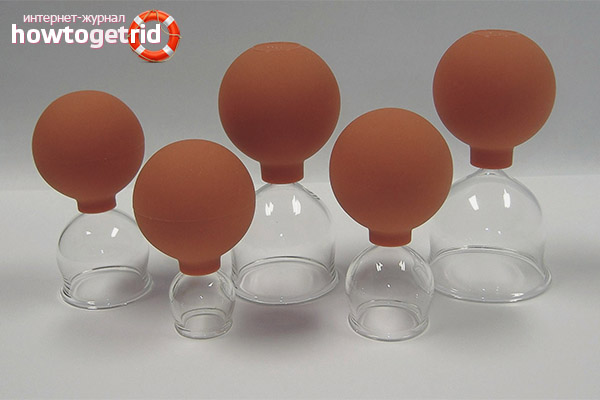 Où se procurer les boîtes à vide