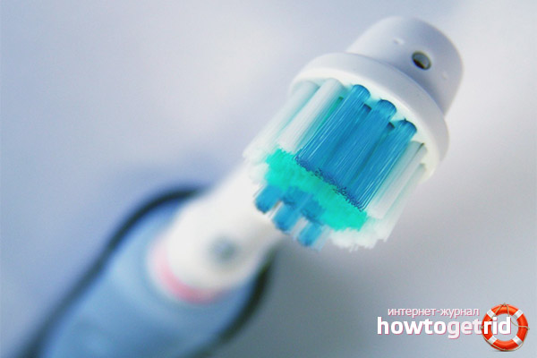 Inconvénients d'une brosse à dents électrique